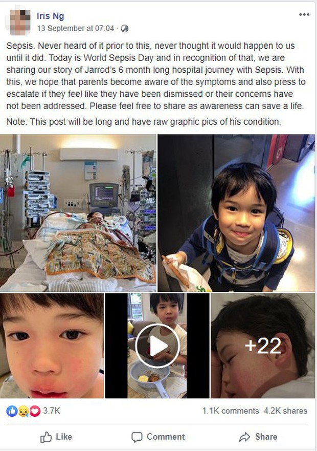 Bé trai 4 tuổi phải nằm viện 6 tháng vì bị nhiễm trùng máu và mắc bệnh do vi khuẩn ăn thịt, triệu chứng ban đầu chỉ là đau chân - Ảnh 1.