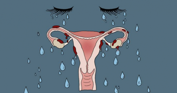 Nữ giới mắc bệnh ung thư buồng trứng thường có 1 trong 4 đặc điểm nổi bật sau đây, điểm nào cũng rất quen thuộc - Ảnh 2.