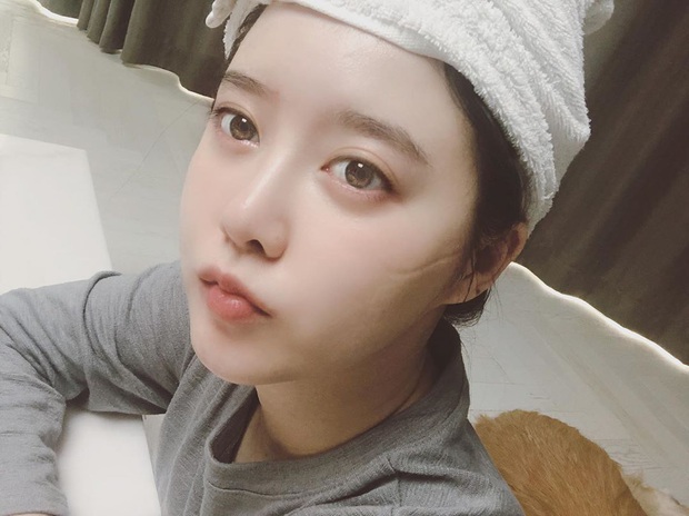 Goo Hye Sun gây xôn xao khi đăng tải ảnh selfie với dòng chú thích kì lạ: Tôi vừa đấu dao với người ngoài hành tinh - Ảnh 5.