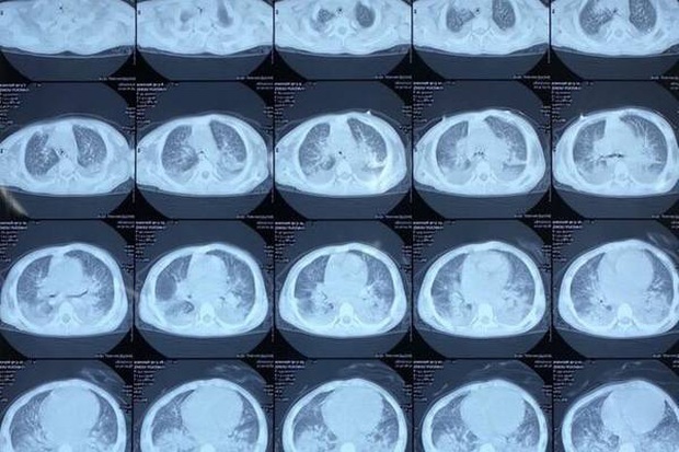 Bé trai Trung Quốc nghi nhiễm virus corona nhập viện khi đi du lịch tại Hải Dương - Ảnh 2. Bé trai Trung Quốc nghi nhiễm virus corona nhập viện khi đi du lịch tại Hải Dương - Ảnh 2.