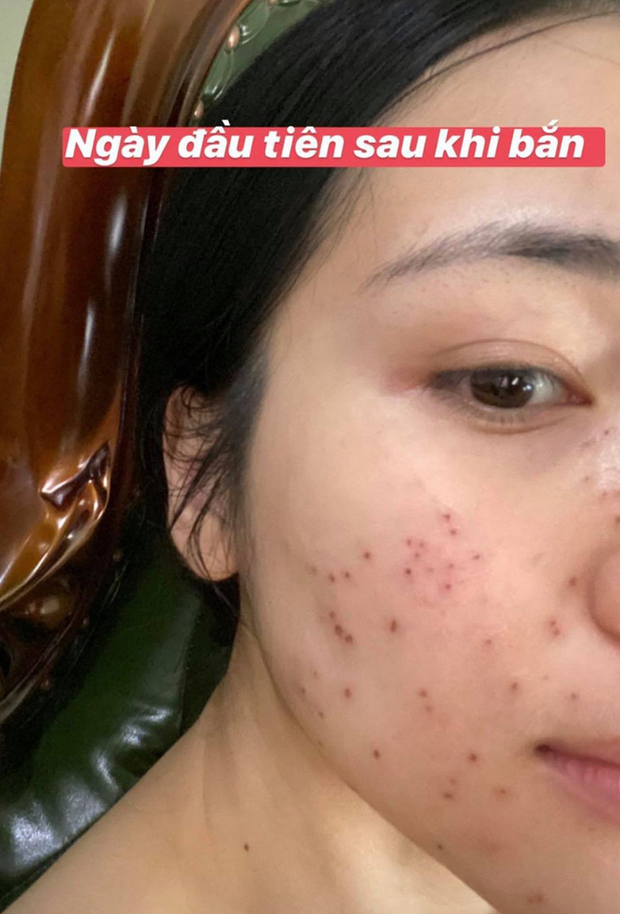 Mỹ nhân Vbiz tự bóc trần khuyết điểm: Hoà Minzy gây sốc với mặt mụ chi chít, Mai Phương Thuý như người khác với 0% make up - Ảnh 6. Mỹ nhân Vbiz tự bóc trần khuyết điểm: Hoà Minzy gây sốc với mặt mụ chi chít, Mai Phương Thuý như người khác với 0% make up - Ảnh 6.