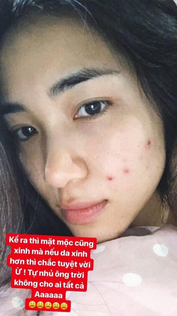 Mỹ nhân Vbiz tự bóc trần khuyết điểm: Hoà Minzy gây sốc với mặt mụ chi chít, Mai Phương Thuý như người khác với 0% make up - Ảnh 7. Mỹ nhân Vbiz tự bóc trần khuyết điểm: Hoà Minzy gây sốc với mặt mụ chi chít, Mai Phương Thuý như người khác với 0% make up - Ảnh 7.