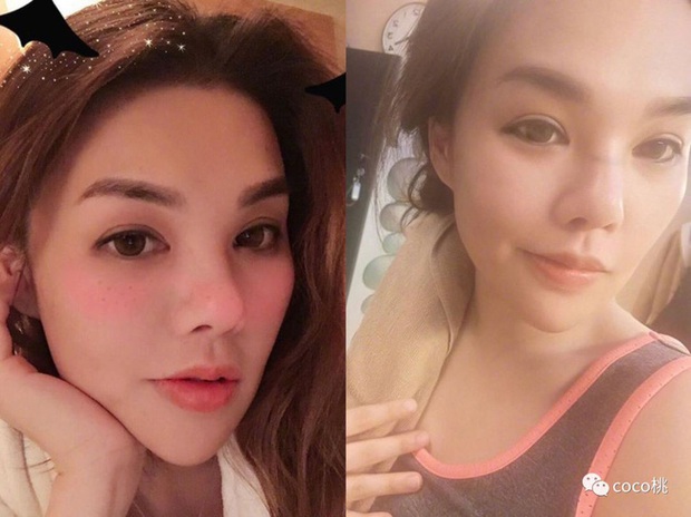 Ái nữ nhà tài phiệt Hồng Kông bất ngờ tử vong khi phẫu thuật thẩm mỹ tại Hàn Quốc, tiết lộ gây sốc về nguyên nhân xảy ra sự cố - Ảnh 1.