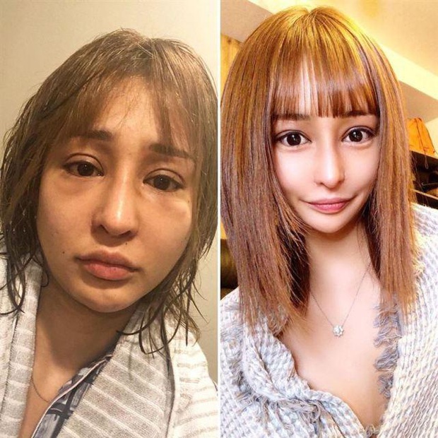 Bị chế giễu xấu như khỉ đột, cô gái cắn răng chịu đựng hơn 100 ca phẫu thuật trong 10 năm để trở thành tiếp viên nổi tiếng nhất Nhật Bản - Ảnh 3.