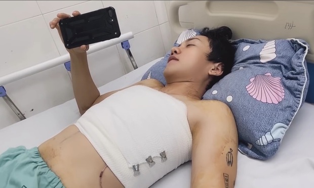 Bạn trai chuyển giới của Miko Lan Trinh lộ diện sau 5 ngày cắt vòng 1, dũng cảm công khai ảnh body hậu phẫu thuật - Ảnh 3. Bạn trai chuyển giới của Miko Lan Trinh lộ diện sau 5 ngày cắt vòng 1, dũng cảm công khai ảnh body hậu phẫu thuật Bạn trai chuyển giới của Miko Lan Trinh lộ diện sau 5 ngày cắt vòng 1, dũng cảm công khai ảnh body hậu phẫu thuật - Ảnh 3. Bạn trai chuyển giới của Miko Lan Trinh lộ diện sau 5 ngày cắt vòng 1, dũng cảm công khai ảnh body hậu phẫu thuật