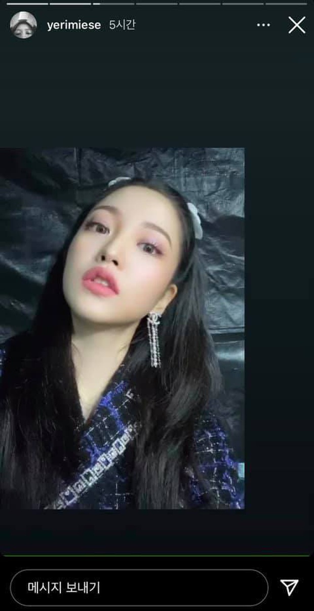 Em út Red Velvet môi tều khác lạ và còn pose đầy khêu gợi, thánh soi tố ngay bắt chước Jennie (BLACKPINK) - Ảnh 2. Em út Red Velvet môi tều khác lạ và còn pose đầy khêu gợi, thánh soi tố ngay bắt chước Jennie (BLACKPINK) - Ảnh 2.