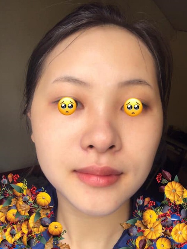 Rẻ vô địch với tip trị thâm môi do đánh son, chỉ cần Vaseline và dầu dừa khiến môi hồng hào, không makeup mà vẫn xinh tươi - Ảnh 3.