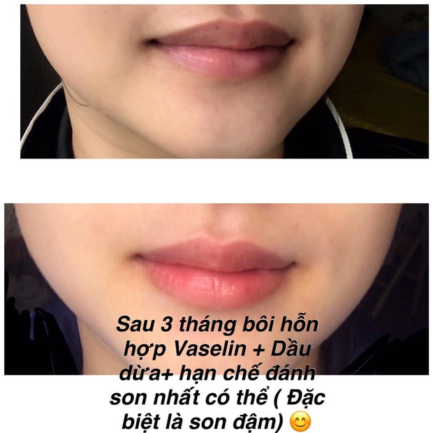 Rẻ vô địch với tip trị thâm môi do đánh son, chỉ cần Vaseline và dầu dừa khiến môi hồng hào, không makeup mà vẫn xinh tươi - Ảnh 1.