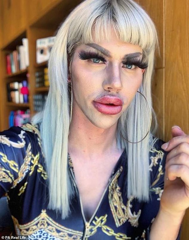 Bỏ 450 triệu đồng để sửa mặt giống búp bê Barbie, hotboy chán nản vì vẫn không tìm được bạn gái - Ảnh 3.