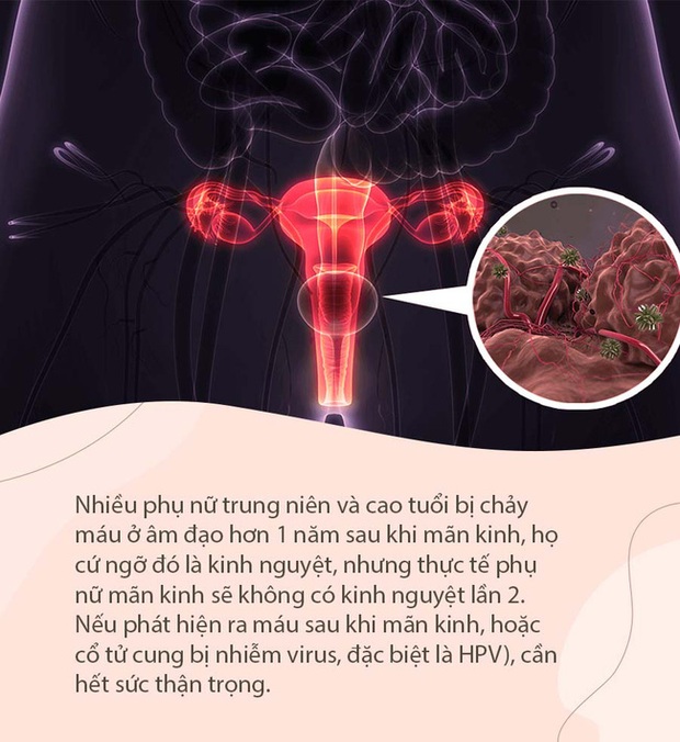 Người phụ nữ phát hiện bị ung thư cổ tử cung bởi một bất thường sau khi mãn kinh mà cũng rất nhiều người hay bỏ qua - Ảnh 2.