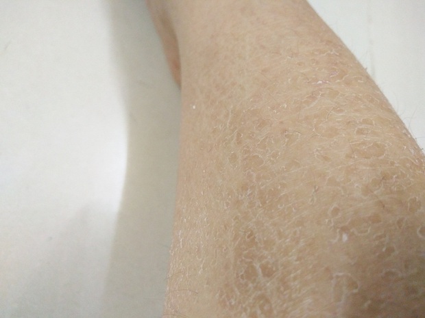 Cứ vào mùa lạnh là da khô ráp bong tróc không khác gì da rắn, chị em cần xem lại ngay mình đã tắm đúng cách chưa? - Ảnh 1. Cứ vào mùa lạnh là da khô ráp bong tróc không khác gì da rắn, chị em cần xem lại ngay mình đã tắm đúng cách chưa? - Ảnh 1.