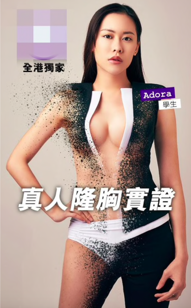 Thí sinh sở hữu hình thể đẹp nhất cuộc thi Hoa hậu châu Á bị bóc nâng ngực, lộ loạt ảnh trong quá khứ một trời một vực - Ảnh 2.