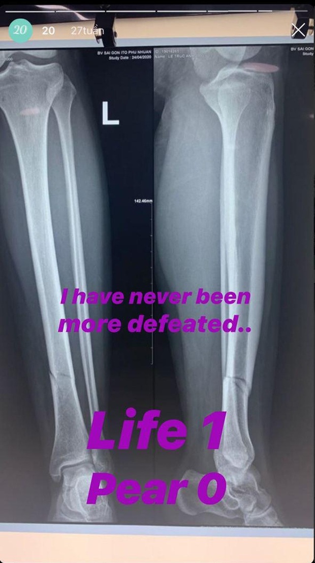 Tình cũ của Huyme bất ngờ xuất hiện trên MXH sau nửa năm ở ẩn - Ảnh 3.