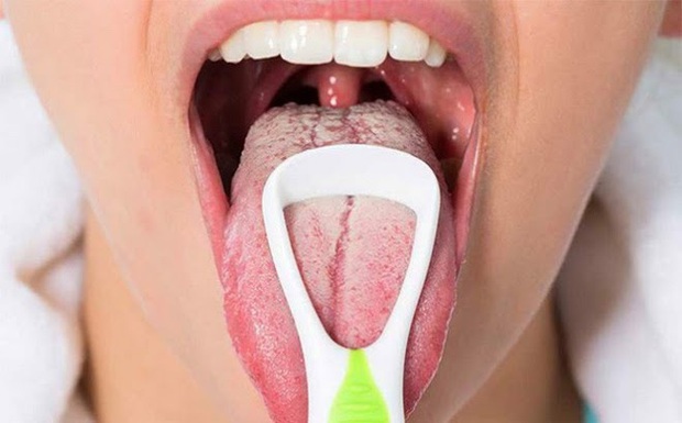 5 vấn đề bạn gặp phải trong mùa này ngầm cho thấy cơ thể đang dư thừa độ ẩm, cần tìm cách cải thiện ngay - Ảnh 2. 5 vấn đề bạn gặp phải trong mùa này ngầm cho thấy cơ thể đang dư thừa độ ẩm, cần tìm cách cải thiện ngay - Ảnh 2.