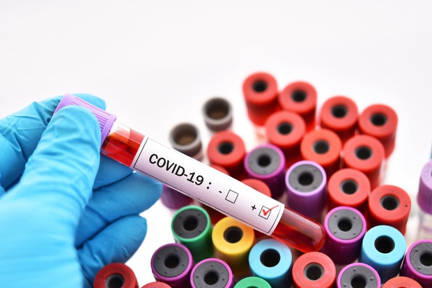Mỹ xác nhận ca COVID-19 đầu tiên không liên quan đến những người nhiễm bệnh trước - Ảnh 1.