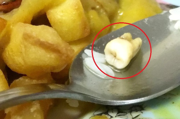 Phát ớn khi đang ăn thì phát hiện có một cái răng người trong đồ ăn của mình, cặp vợ chồng lên mạng đăng đàn phẫn nộ nhà hàng đồ ăn Trung Hoa - Ảnh 1. Phát ớn khi đang ăn thì phát hiện có một cái răng người trong đồ ăn của mình, cặp vợ chồng lên mạng đăng đàn phẫn nộ nhà hàng đồ ăn Trung Hoa - Ảnh 1.