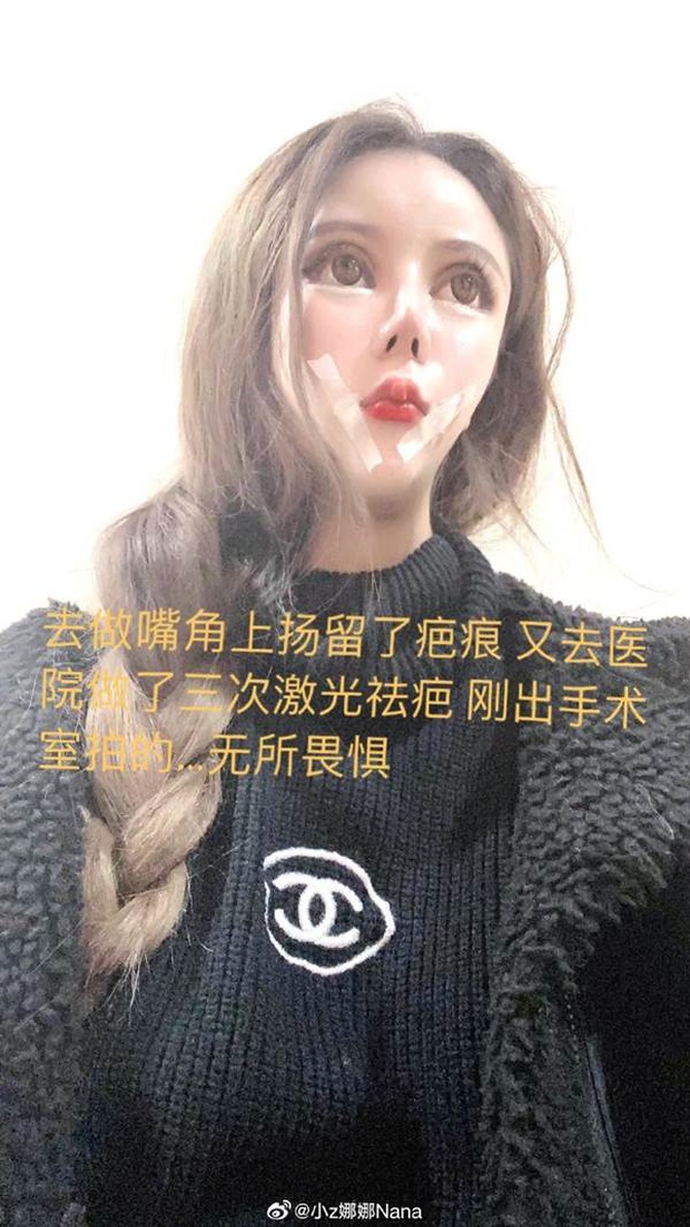 Nghiện phẫu thuật thẩm mỹ từ năm 13 tuổi, thiếu nữ khiến cộng đồng mạng tá hỏa khi công khai những bức ảnh xinh đẹp nhất của mình - Ảnh 2. Nghiện phẫu thuật thẩm mỹ từ năm 13 tuổi, thiếu nữ khiến cộng đồng mạng tá hỏa khi công khai những bức ảnh xinh đẹp nhất của mình - Ảnh 2.