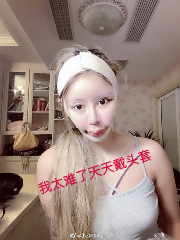 Nghiện phẫu thuật thẩm mỹ từ năm 13 tuổi, thiếu nữ khiến cộng đồng mạng tá hỏa khi công khai những bức ảnh xinh đẹp nhất của mình - Ảnh 3. Nghiện phẫu thuật thẩm mỹ từ năm 13 tuổi, thiếu nữ khiến cộng đồng mạng tá hỏa khi công khai những bức ảnh xinh đẹp nhất của mình - Ảnh 3.