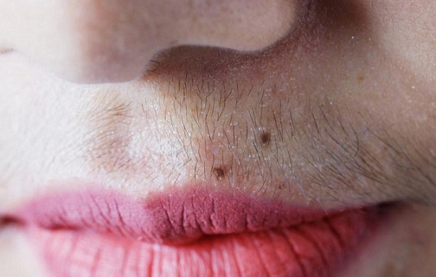 Nữ giới mắc bệnh phụ khoa thường dễ gặp phải 4 triệu chứng xấu trên đôi môi, check xem bạn có gặp phải triệu chứng nào không - Ảnh 4.