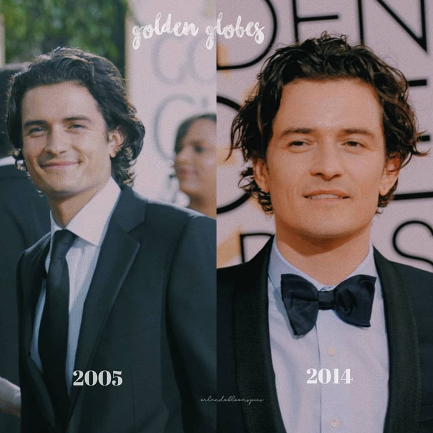 Looking at the beauty of Orlando Bloom, people hold their breath even more waiting for the tiny visual masterpiece that Katy Perry is pregnant with - Photo 15.