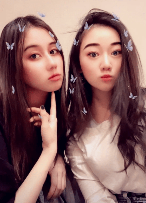 Ảnh tháo niềng răng của thiên kim tiểu thư út ít gia tộc trùm sòng bạc Macau gây sốt: Nhan sắc thăng cấp quá ngoạn mục! - Ảnh 2. Ảnh tháo niềng răng của thiên kim tiểu thư út ít gia tộc trùm sòng bạc Macau gây sốt: Nhan sắc thăng cấp quá ngoạn mục! - Ảnh 2.