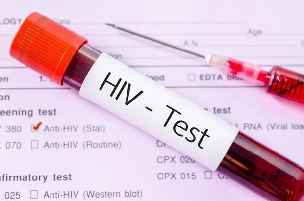 Bí mật trong máu tôi: Bi kịch cuộc đời của cậu bé nhiễm HIV mà không dám tiết lộ với bất kỳ ai, án tử đến từ mũi tiêm chữa bệnh và cú lội ngược dòng ngoạn mục - Ảnh 3.