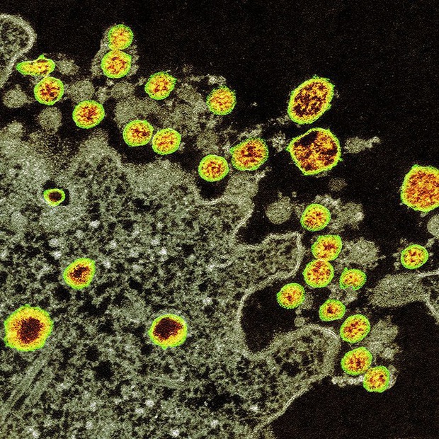 Đại dịch COVID-19 trong những tấm ảnh: Virus corona đã thay đổi thế giới của chúng ta như thế nào? - Ảnh 1.