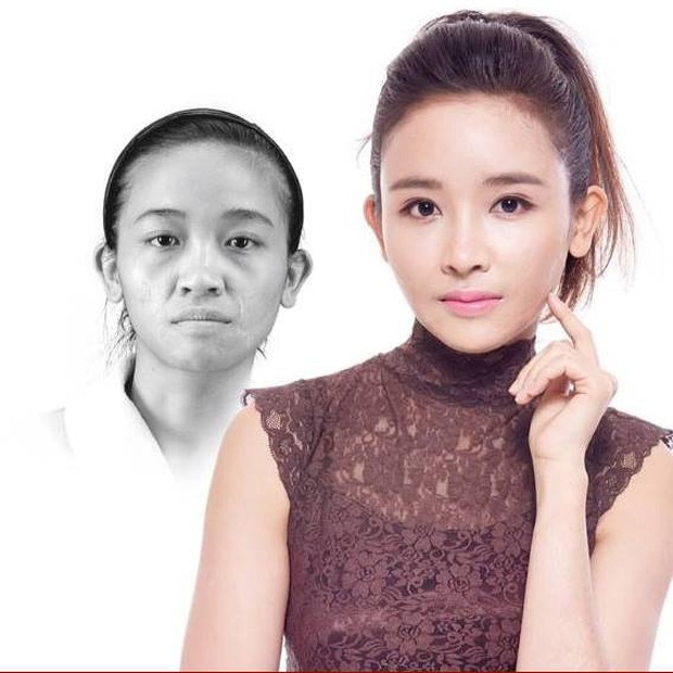 Ngoài nữ chính Người ấy là ai, đây là những ca lột xác đáng kinh ngạc khi tham gia show thực tế phẫu thuật thẩm mỹ! - Ảnh 7.