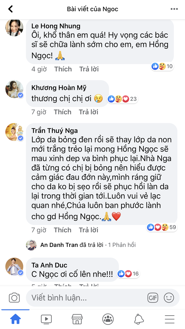 Ca sĩ Hồng Ngọc hé lộ ảnh cận vết bỏng nặng trên mặt, dàn nghệ sĩ Vbiz chạnh lòng rơi nước mắt - Ảnh 6.