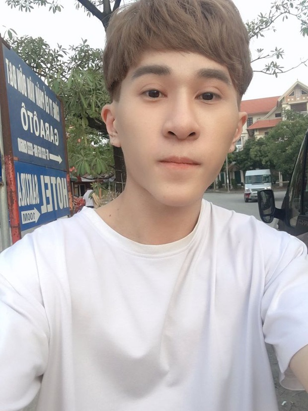 Chàng vũ công mặc cảm khi bị học viên ví như khỉ đột, vượn người và hành trình lột xác: Thà đẹp nhân tạo còn hơn xấu tự nhiên! - Ảnh 4.