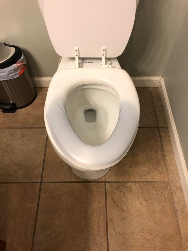 Ghế toilet chuyển màu xanh, màu tím sau khi đi vệ sinh: Hiện tượng tưởng hài hước hóa ra lại là mối nguy hiểm khôn lường - Ảnh 2.