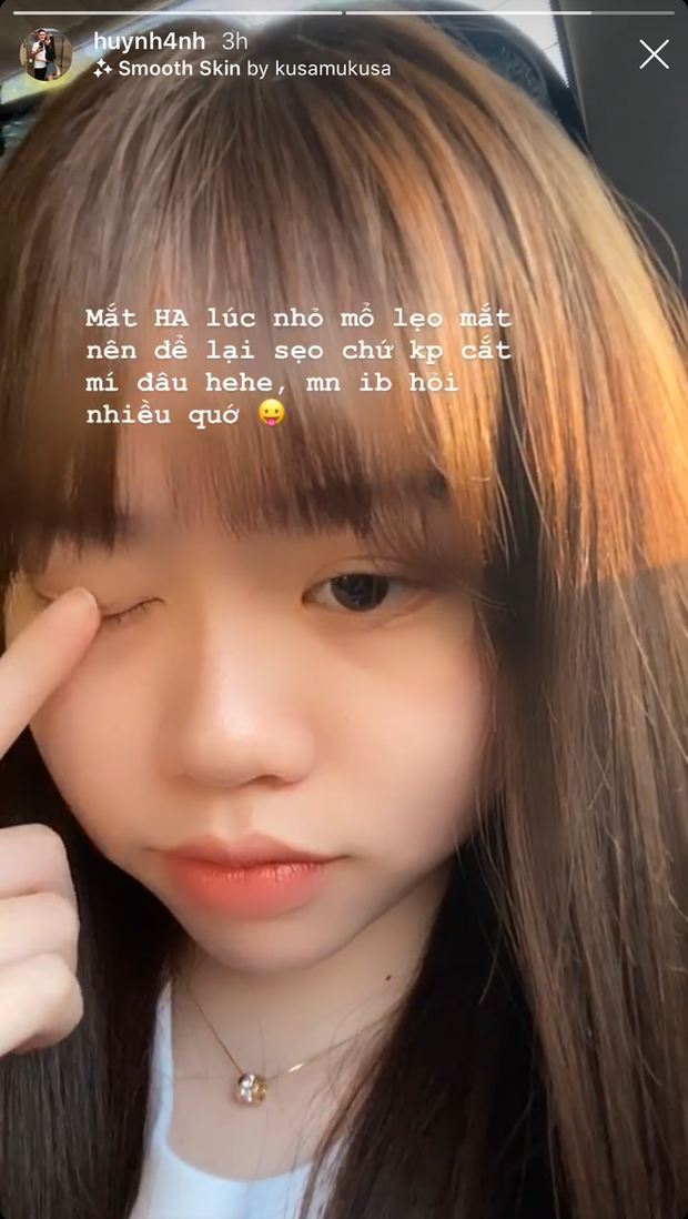 Nói chung là vẫn chưa hết bị soi, bạn gái Quang Hải vừa lý giải vì sao có đôi mắt trông như cắt mí - Ảnh 2.