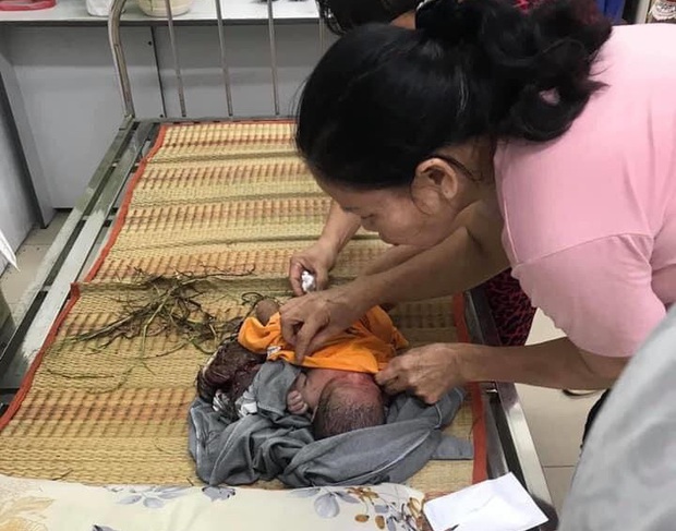 Bình Dương: Một bé sơ sinh còn nguyên dây rốn bị bỏ rơi ngoài bãi cỏ - Ảnh 1.
