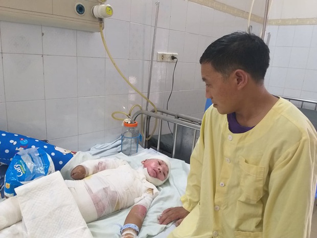 Trèo lên cột điện bắt chim, bé trai 12 tuổi bị điện giật phải cắt bỏ tay chân, tương lai mịt mù - Ảnh 3. Trèo lên cột điện bắt chim, bé trai 12 tuổi bị điện giật phải cắt bỏ tay chân, tương lai mịt mù - Ảnh 3.