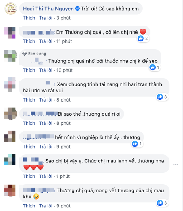 Hari Won bị chấn thương tại chương trình, Trấn Thành liền có phản ứng phũ đến mức bị vợ bóc phốt lên mạng - Ảnh 3.