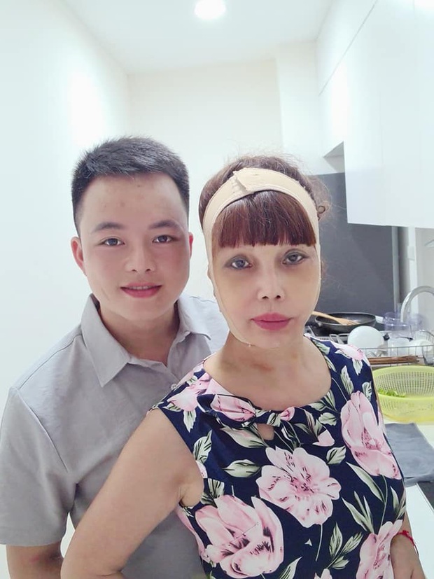 Sự thật hình ảnh gương mặt sưng phù, biến dạng của cô dâu 62 tuổi ở Cao Bằng và sự cưng nựng của chồng trẻ kém 36 tuổi gây bất ngờ - Ảnh 4. Sự thật hình ảnh gương mặt sưng phù, biến dạng của cô dâu 62 tuổi ở Cao Bằng và sự cưng nựng của chồng trẻ kém 36 tuổi gây bất ngờ - Ảnh 4.