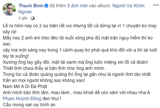 Diễn viên Huỳnh Đông gặp tai nạn, xương ống tay gãy đôi vì ghi hình phim mới - Ảnh 1.