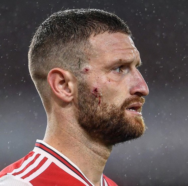 Tung cú kung-fu khiến mặt đối phương thủng lỗ chỗ nhưng tiền đạo Leicester vẫn được trọng tài khoan hồng - Ảnh 4.