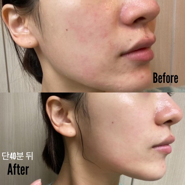 Thành phần siêu sao trong cuộc đua chống già: Ngoài Vit C, Retinol còn 5 ứng viên nữa mà bạn chưa biết tới - Ảnh 9.