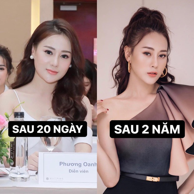 Quỳnh Búp Bê Phương Oanh tự so sánh dung nhan gây tranh cãi trước và sau 7 năm, công khai chuyện đụng chạm dao kéo để trùng tu sắc đẹp - Ảnh 5.