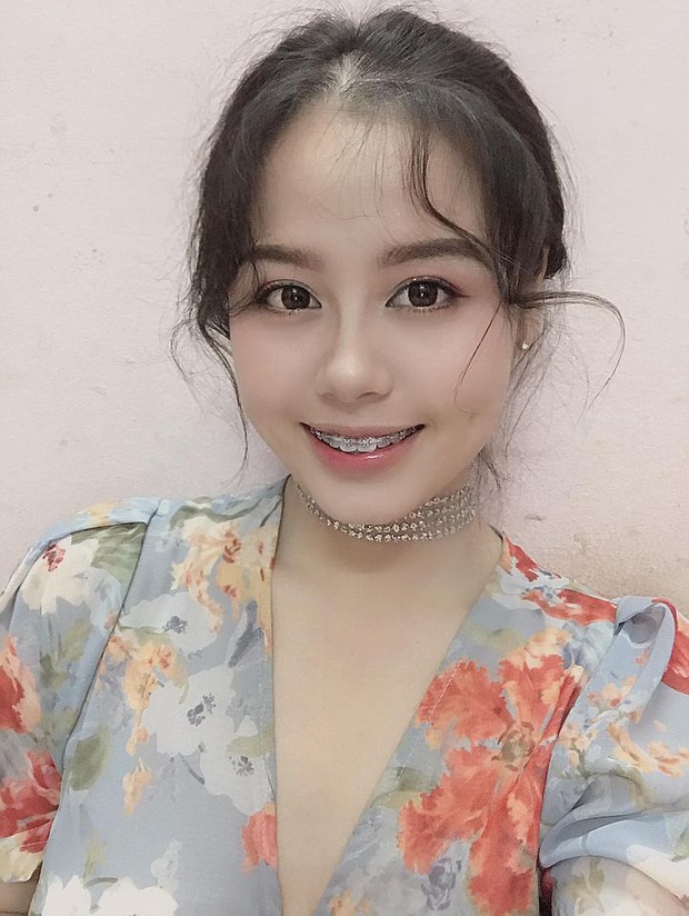 Cô bạn khoe ảnh niềng răng vẫn xinh bất chấp, quá khứ giảm cân lột xác càng gây bất ngờ hơn - Ảnh 1. Cô bạn khoe ảnh niềng răng vẫn xinh bất chấp, quá khứ giảm cân lột xác càng gây bất ngờ hơn - Ảnh 1.