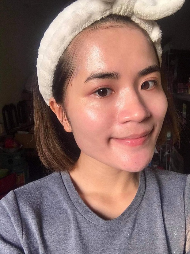 Da mụn chi chít hóa căng bóng ai nhìn cũng mê chỉ sau 1 năm: Nàng 9x chia sẻ 4 bước phục hồi da kèm review 7 sản phẩm tin tưởng nhất - Ảnh 4. Da mụn chi chít hóa căng bóng ai nhìn cũng mê chỉ sau 1 năm: Nàng 9x chia sẻ 4 bước phục hồi da kèm review 7 sản phẩm tin tưởng nhất - Ảnh 4.