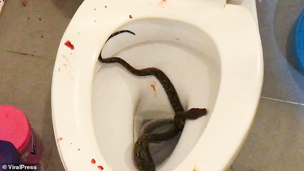 Chàng trai bị rắn phục kích trong bồn cầu đớp trúng của quý khi đang đi vệ sinh - Ảnh 3.