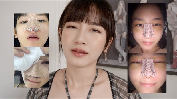 Loạt gái xinh chả giấu chuyện sửa mũi - “vũ khí huỷ diệt” giúp nhan sắc lên hương - Ảnh 3.