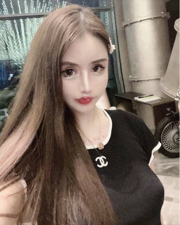Nghiện dao kéo từ năm 13 tuổi, gương mặt sau hơn 100 lần phẫu thuật thẩm mỹ của hot girl xứ Trung khiến ai nhìn cũng sửng sốt - Ảnh 3.