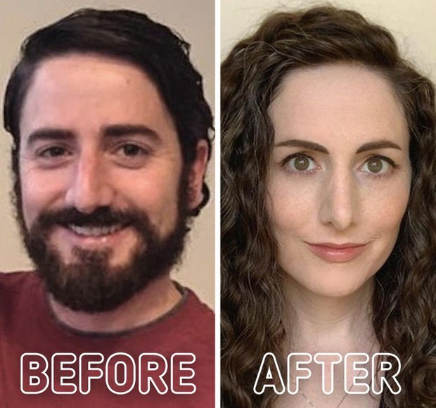 Loạt ảnh trước - sau của những ca phẫu thuật chuyển giới thành công mĩ mãn chứng tỏ khi được là chính mình bạn mới tỏa sáng rực rỡ nhất - Ảnh 3.