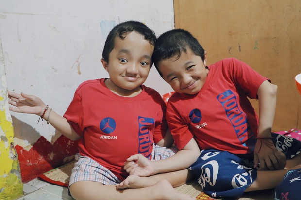 Đôi song sinh khuyết tật 14 tuổi hát cực hay, theo mẹ bán vé số khắp Sài Gòn: Cha tụi con mất rồi, chỉ còn có mẹ thôi - Ảnh 3. Đôi song sinh khuyết tật 14 tuổi hát cực hay, theo mẹ bán vé số khắp Sài Gòn: Cha tụi con mất rồi, chỉ còn có mẹ thôi - Ảnh 3.