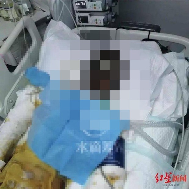Hot TikTok-er bị phỏng nặng do chồng cũ tạt xăng thiêu sống khi đang livestream, lộ hình ảnh sau tai nạn khiến mọi người hoảng sợ - Ảnh 2. Hot TikTok-er bị phỏng nặng do chồng cũ tạt xăng thiêu sống khi đang livestream, lộ hình ảnh sau tai nạn khiến mọi người hoảng sợ - Ảnh 2.