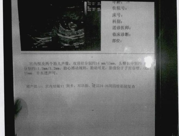 Bạn gái đi Mỹ tu nghiệp nhưng lỡ mang song thai, người đàn ông chu cấp hơn 800 triệu rồi phát hiện kịch bản lừa đảo đầy tinh vi - Ảnh 2.