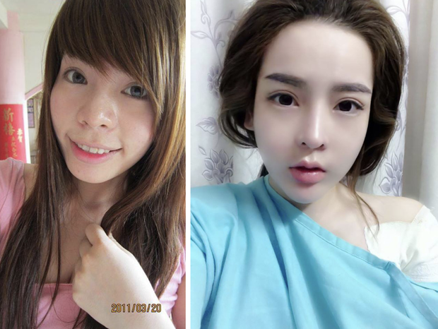 Những hot girl dao kéo đình đám một thời: Người lấy chồng đại gia, người vẫn miệt mài mỗi lần sinh là một lần sửa - Ảnh 9.